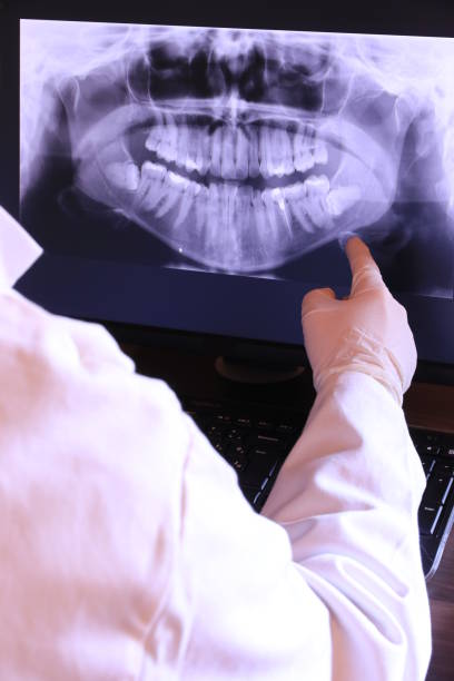 Best Chipped Tooth Repair Near Me  in Sylacauga, AL