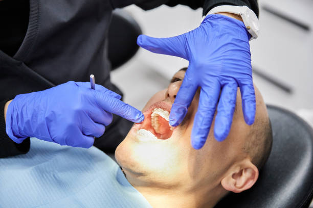 Best Dentist for Tooth Abscess  in Sylacauga, AL